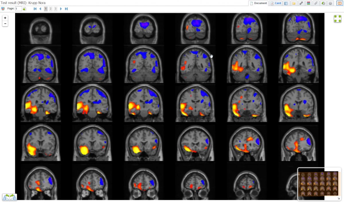 MD - 7_-_MRI